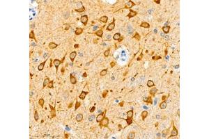 Immunohistochemistry of paraffin embedded mouse brain using NECAB1 (ABIN7074753) at dilution of 1: 5000 (400x lens) (NECAB1 anticorps)