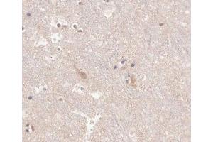 ABIN6266625 at 1/100 staining human brain tissue sections by IHC-P. (KCNC2 anticorps  (C-Term))