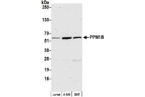 Western Blotting (WB) image for anti-Protein Phosphatase, Mg2+/Mn2+ Dependent, 1B (PPM1B) (C-Term) antibody (ABIN7450594)