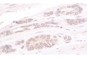 Immunohistochemistry (IHC) image for anti-ATR Interacting Protein (ATRIP) (AA 100-150) antibody (ABIN7453575) (ATRIP anticorps  (AA 100-150))