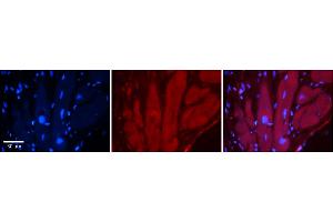 Rabbit Anti-TRPV4 Antibody  Catalog Number: ARP35331_P050 Formalin Fixed Paraffin Embedded Tissue: Human Adult heart  Observed Staining: Cytoplasmic Primary Antibody Concentration: 1:100 Secondary Antibody: Donkey anti-Rabbit-Cy2/3 Secondary Antibody Concentration: 1:200 Magnification: 20X Exposure Time: 0.
