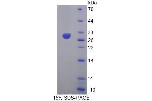 SDS-PAGE analysis of Human MFN1 Protein.