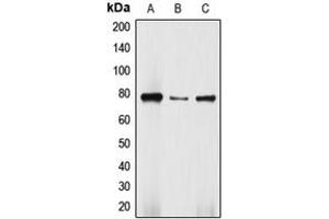 Western blot analysis of DBF4 expression in Jurkat (A), HepG2 (B), SW480 (C) whole cell lysates. (DBF4 anticorps  (N-Term))