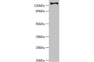 Western blot All lanes: RET antibody at 6 μg/mL + Hela whole cell lysate Secondary Goat polyclonal to rabbit IgG at 1/10000 dilution Predicted band size: 125, 120 kDa Observed band size: 125 kDa (Ret Proto-Oncogene anticorps  (AA 29-300))