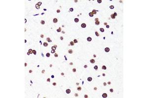 Immunohistochemistry of paraffin-embedded rat brain using H3K36me2 antibody.