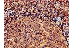 IHC image of ABIN7154415 diluted at 1:800 and staining in paraffin-embedded human tonsil tissue performed on a Leica BondTM system.
