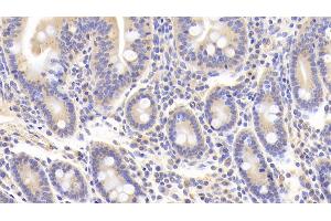 Detection of NOG in Human Small intestine Tissue using Polyclonal Antibody to Noggin (NOG)