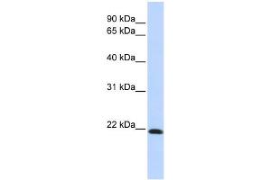 WB Suggested Anti-CLDN7 Antibody Titration:  0. (Claudin 7 anticorps  (Middle Region))