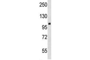 PRMT10 antibody western blot analysis in mouse cerebellum tissue lysate. (PRMT10 anticorps  (AA 39-68))