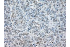 Immunohistochemical staining of paraffin-embedded Ovary tissue using anti-SORDmouse monoclonal antibody. (SORD anticorps)