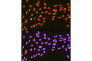 Immunofluorescence analysis of C6 cells using EWSR1 Rabbit mAb (ABIN7267053) at dilution of 1:100 (40x lens).