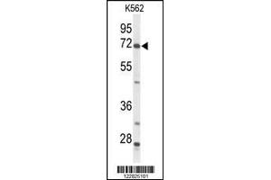 Western blot analysis of ACSS2 Antibody in K562 cell line lysates (35ug/lane) (ACSS2 anticorps  (N-Term))