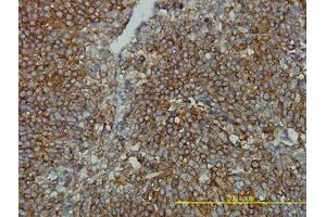 Image no. 1 for anti-Clathrin, Light Chain B (CLTB) (AA 1-212) antibody (ABIN598618) (CLTB anticorps  (AA 1-212))
