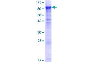 Image no. 1 for Bardet-Biedl Syndrome 2 (BBS2) (AA 1-721) protein (GST tag) (ABIN1346471)