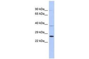 Image no. 1 for anti-SAR1 Homolog B (SAR1B) (AA 107-156) antibody (ABIN6744023) (SAR1B anticorps  (AA 107-156))
