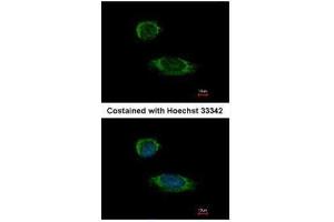 ICC/IF Image Immunofluorescence analysis of methanol-fixed HeLa, using Caspase 1 alpha, antibody at 1:500 dilution. (Caspase 1 anticorps)