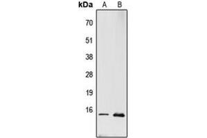Western blot analysis of RPL22 expression in PC12 (A), MCF7 (B) whole cell lysates. (RPL22 anticorps  (Center))