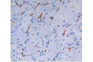 IHC-P analysis of Mouse Brain Tissue, with DAB staining. (Albumin anticorps)
