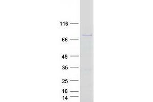 Validation with Western Blot