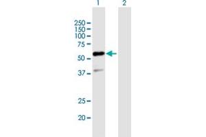 Western Blot analysis of GTF2E1 expression in transfected 293T cell line by GTF2E1 MaxPab polyclonal antibody. (GTF2E1 anticorps  (AA 1-439))