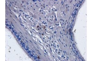 Immunohistochemical staining of rat epididymis tissue using anti-CD52 antibody.