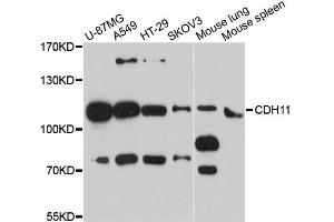 Western blot analysis of extracts of various cell lines, using CDH11 antibody. (OB Cadherin anticorps)