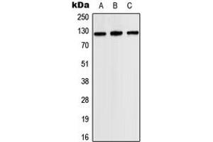 Western blot analysis of JAK2 expression in HEK293T (A), SP2/0 (B), H9C2 (C) whole cell lysates. (JAK2 anticorps  (Center))