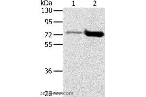 Western blot analysis of Human testis and human placenta tissue, using PIAS1 Polyclonal Antibody at dilution of 1:200 (PIAS1 anticorps)