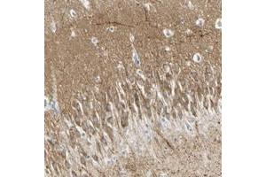 Immunohistochemical staining of human hippocampus with MAGI3 polyclonal antibody  shows mocerate cytoplasmic positivity in neuronal cells and neuropil at 1:20-1:50 dilution. (MAGI3 anticorps)