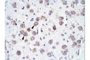 Image no. 1 for anti-RNA-binding protein Raly (RALY) (N-Term) antibody (ABIN6735882)