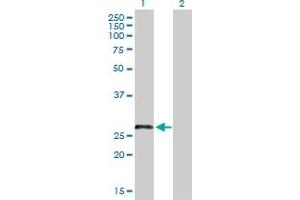 Western Blot analysis of LRRN4CL expression in transfected 293T cell line by LRRN4CL MaxPab polyclonal antibody. (LRRN4CL anticorps  (AA 1-238))