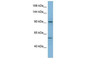 WB Suggested Anti-ATP2A1 Antibody Titration:  0. (ATP2A1/SERCA1 anticorps  (N-Term))