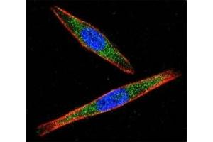 Confocal immunofluorescent analysis of LCK antibody with A2058 cells followed by Alexa Fluor 488-conjugated goat anti-rabbit lgG (green).