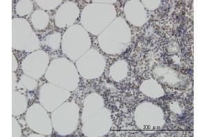 Image no. 3 for anti-N-Methylpurine-DNA Glycosylase (MPG) (AA 1-90) antibody (ABIN598819) (MPG anticorps  (AA 1-90))