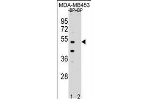Western blot analysis of WDR51B Antibody Pab pre-incubated without(lane 1) and with(lane 2) blocking peptide in MDA-MB453 cell line lysate.