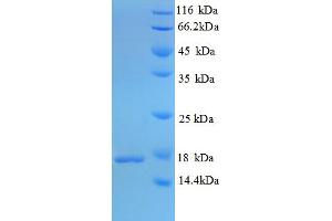 SDS-PAGE (SDS) image for Immunogenic Protein MPT63 (MPT63) (AA 30-159) protein (His tag) (ABIN5712950) (MPT63 Protein (AA 30-159) (His tag))