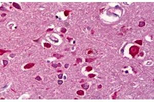 Anti-WISP2 antibody IHC staining of human brain, cortex.