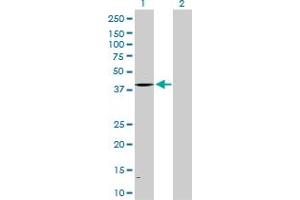 Western Blot analysis of ALAD expression in transfected 293T cell line by ALAD MaxPab polyclonal antibody. (ALAD anticorps  (AA 1-339))