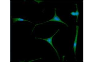 ICC/IF analysis of APP in U87MG cells line, stained with DAPI (Blue) for nucleus staining and monoclonal anti-human APP antibody (1:100) with goat anti-mouse IgG-Alexa fluor 488 conjugate (Green).