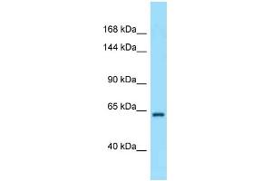 Western Blotting (WB) image for anti-Ras Association and DIL Domains (Radil) (C-Term) antibody (ABIN2789579) (Radil anticorps  (C-Term))