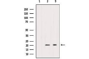 Western blot analysis of extracts from various samples, using Caveolin 1 Antibody. (Caveolin-1 anticorps  (C-Term))