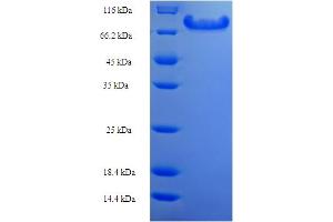SDS-PAGE (SDS) image for Angiopoietin-Like 2 (ANGPTL2) (AA 23-493) protein (His-SUMO Tag) (ABIN5711949)