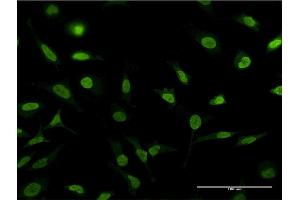 Immunofluorescence of monoclonal antibody to PSMA1 on HeLa cell. (PSMA1 anticorps  (AA 1-263))