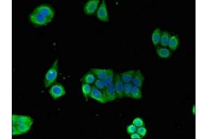 Immunofluorescent analysis of PC-3 cells using ABIN7153928 at dilution of 1:100 and Alexa Fluor 488-congugated AffiniPure Goat Anti-Rabbit IgG(H+L) (GPI anticorps  (AA 2-554))