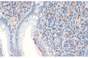 Immunohistochemistry of paraffin-embedded Human appendix using SST Polyclonal Antibody at dilution of 1:200 (40x lens).