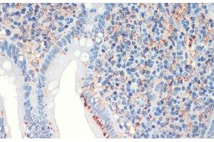 Immunohistochemistry of paraffin-embedded Human appendix using SST Polyclonal Antibody at dilution of 1:200 (40x lens). (Somatostatin anticorps)