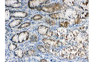 IHC analysis of ALDH1A3 using anti- ALDH1A3 antibody .