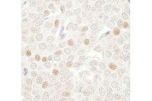 Immunohistochemistry (IHC) image for anti-Cell Division Cycle 20 Homolog (S. Cerevisiae) (CDC20) (AA 50-100) antibody (ABIN7448465) (CDC20 anticorps  (AA 50-100))