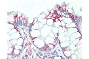 Anti-RPL8 / L8 antibody IHC staining of human colon. (RPL8 anticorps  (C-Term))