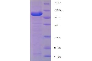 SDS-PAGE (SDS) image for Lysyl Oxidase-Like 1 (LOXL1) (AA 95-607) protein (His tag) (ABIN5709871) (LOXL1 Protein (AA 95-607) (His tag))